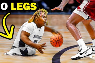 This Teen Hooper Has NO LEGS..