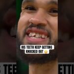 Derrick White got his teeth knocked out AGAIN 🤕