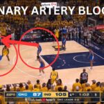 OKLAHOMA CITY THUNDER coronary artery blocking coaching vs. PACERS | GAME 6