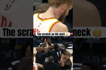 Jock Landale was just trying to break it up 😅