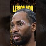 SE LESIONÓ KAWHI LEONARD! #nba #basketball #baloncesto