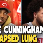 Jeff Teague REACTS to Cade Cunningham collapsed lung diagnosis, OUT for "extended period" of time