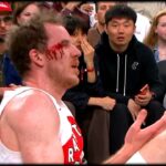 Jakob Poeltl eats an elbow to the face vs Clippers 🤕