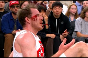 Jakob Poeltl eats an elbow to the face vs Clippers 🤕